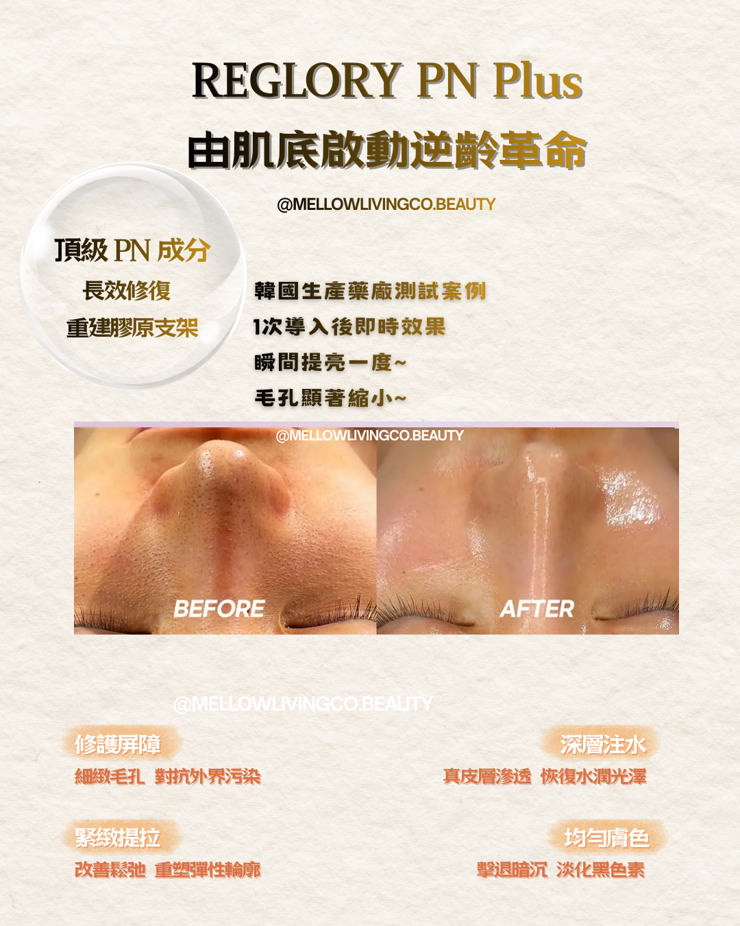 REGLORY PN Plus 韓國逆齡革命水光療程