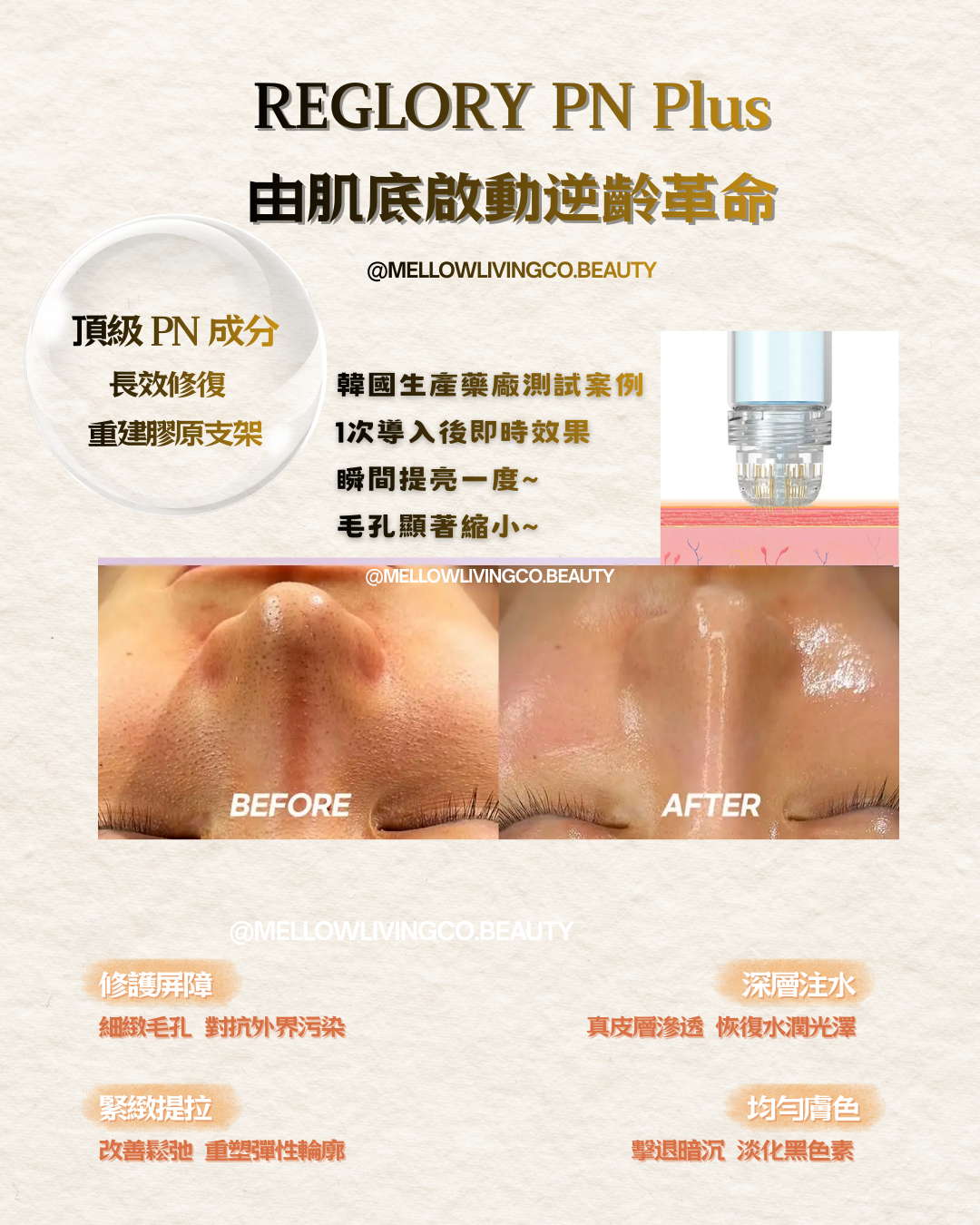 REGLORY PN Plus 韓國逆齡革命水光療程