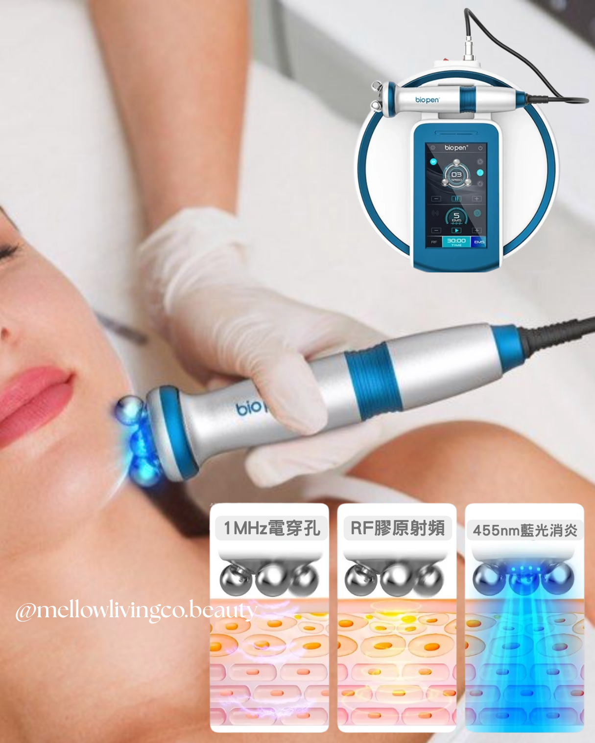 biopen T6 小電波 三合一專業美容儀