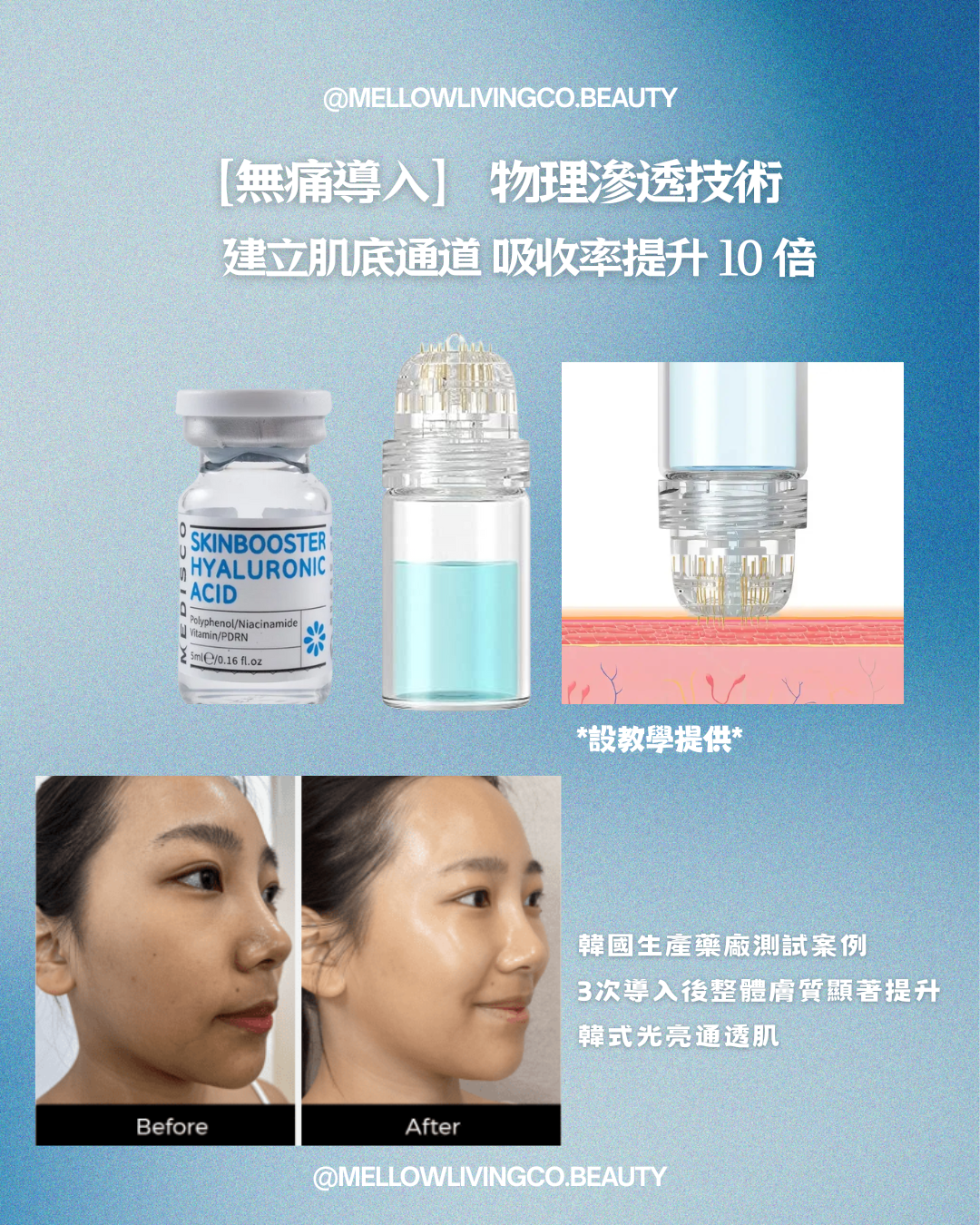 MEDISCO 韓國水光活氧療程