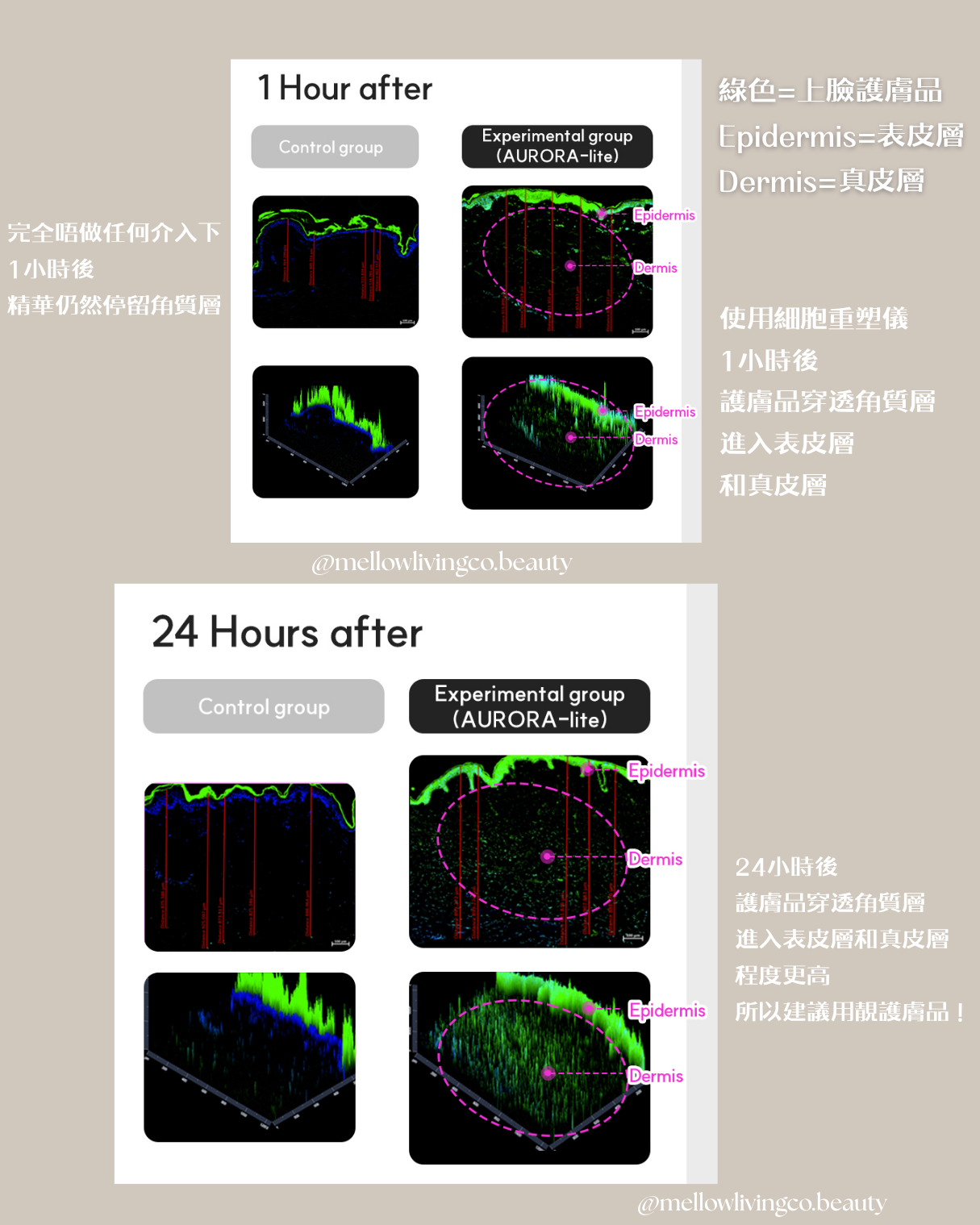 韓國 SAY SKIN 等離子細胞重塑儀