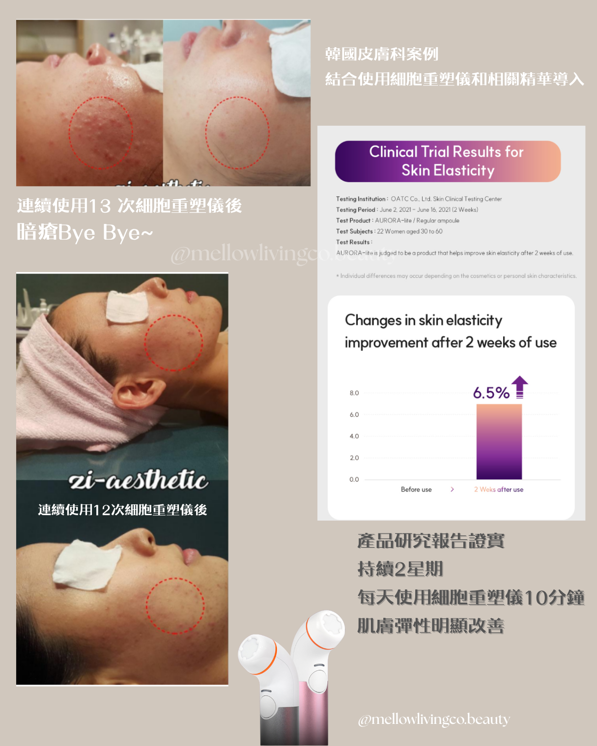 韓國 SAY SKIN 等離子細胞重塑儀