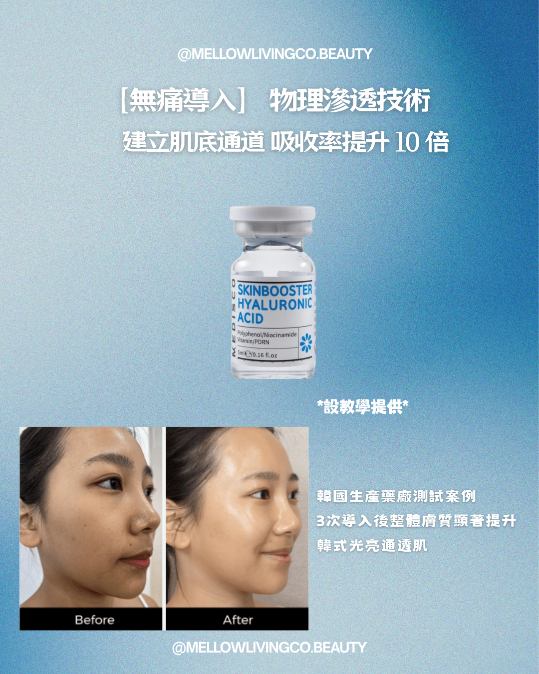 MEDISCO 韓國水光活氧療程